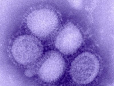 h1n1_influenza_virus.jpeg